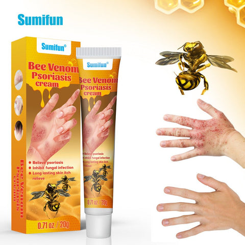 Summifun - Bee Venom Psoriasis Cream (Original