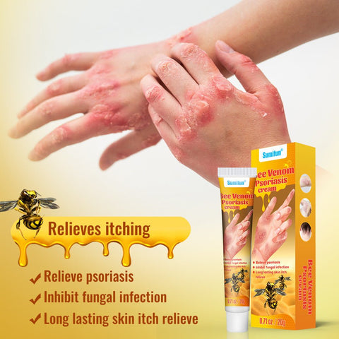 Summifun - Bee Venom Psoriasis Cream (Original