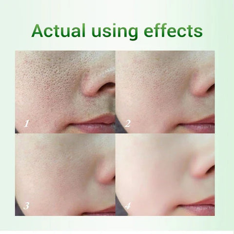 skin care cream 100%