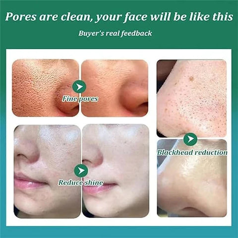 Whitening Facial